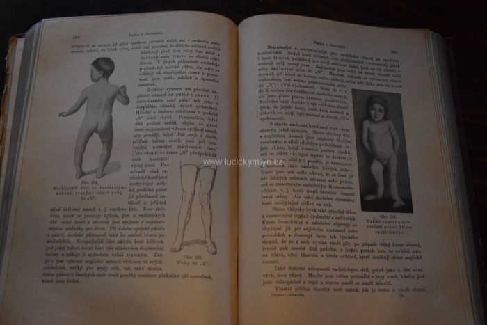Originální starožitné knihy „Domácí lékařka“, Mudr. Jenny Springerová